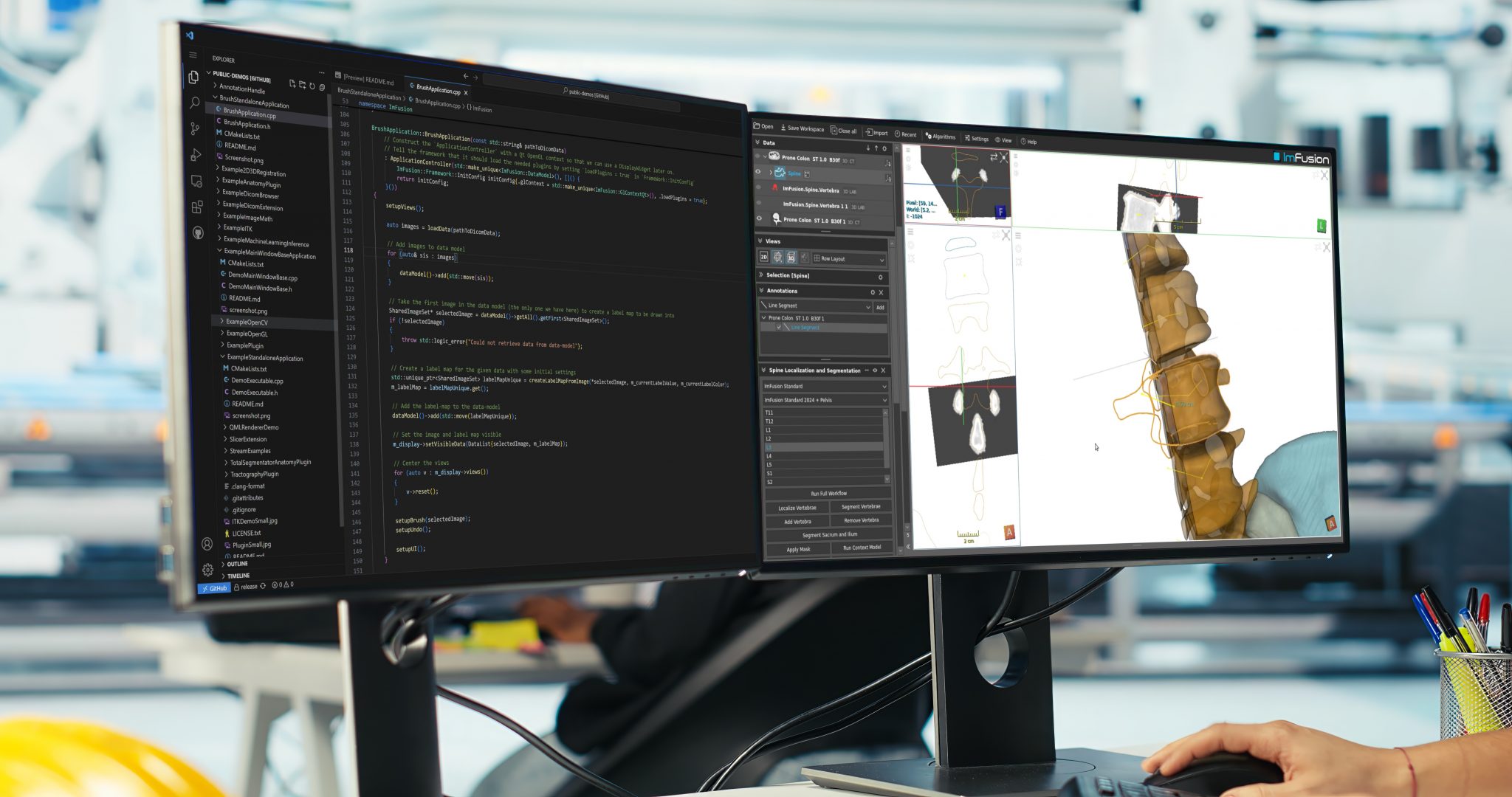 Software Development Kit (SDK) - ImFusion